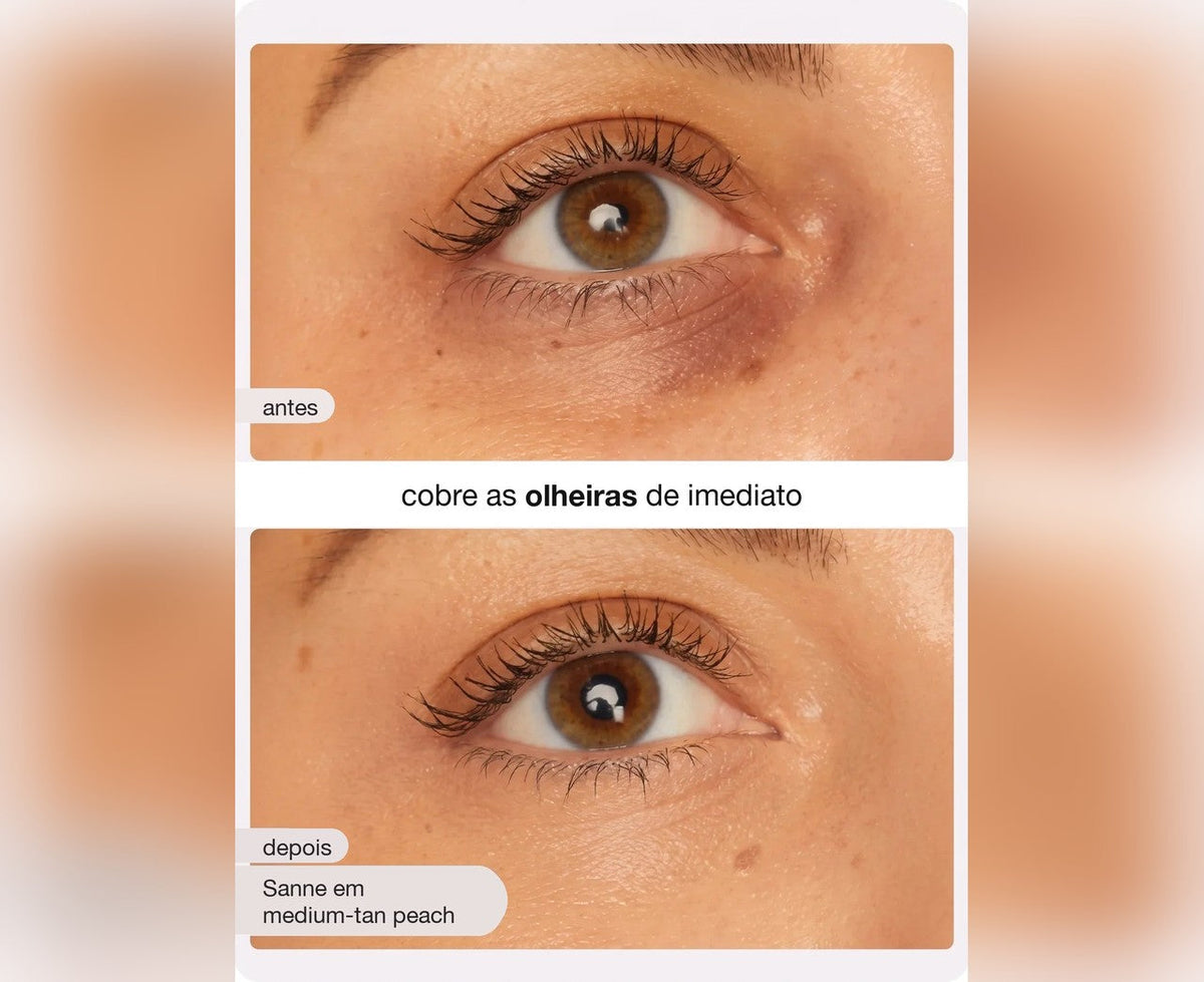 Antes e depois – cobre as olheiras de imediato