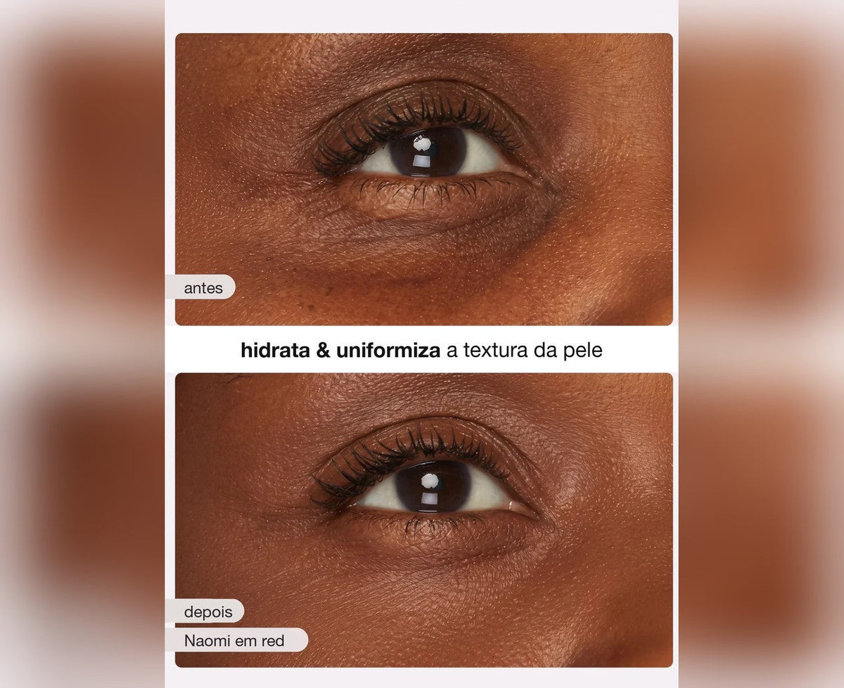 Antes e depois – hidrata e uniformiza a textura da pele